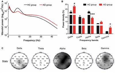 Enhanced Gamma Activity and Cross-Frequency Interaction of Resting-State Electroencephalographic Oscillations in Patients with Alzheimer’s Disease